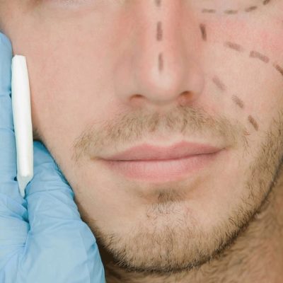 Five Cosmetic Surgery Procedures Currently Popular With Men